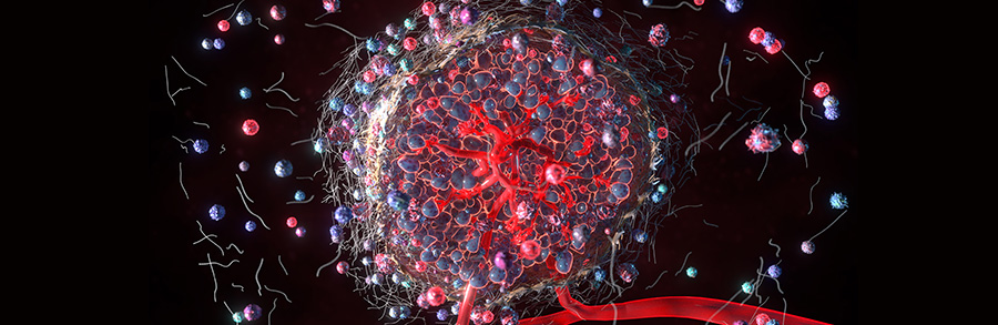 Ovarian cancer cell